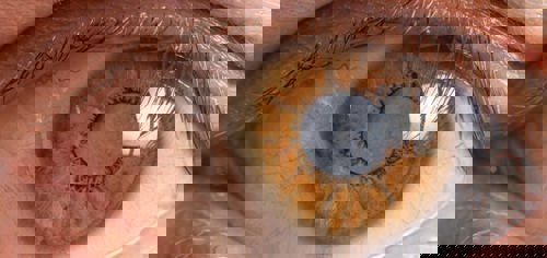 Glaucoma What Is Trabeculectomy