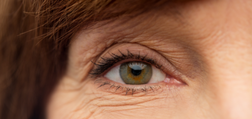 Dangers Of Eyelid Laxity