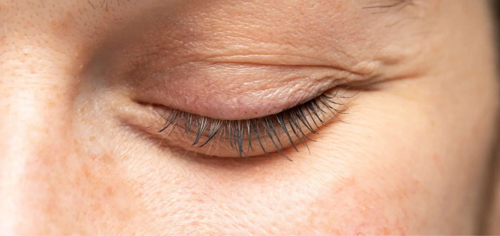 Oculoplastic Treatments Surgery Ocl Vision