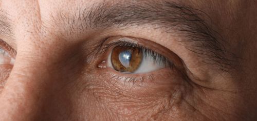 OCL Vision Cataract Surgery